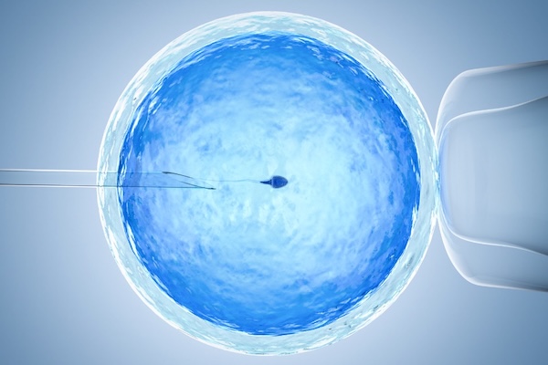 Intrauterine Insemination